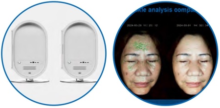 Анализатор кожи MBT SKIN ANALYZER